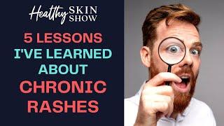 5 THINGS You Need To Know About Skin Rashes | Jennifer Fugo