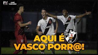 VASCO VIRA NA COPA DO BRASIL COM A MÃO DO PAIVA | HUGO MOURA É O DESTAQUE | CAFÉ VASCAÍNO