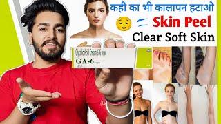 कही का भी कालापन हटाओ | Glycolic Acid 6% Cream | GA 6 Cream Review