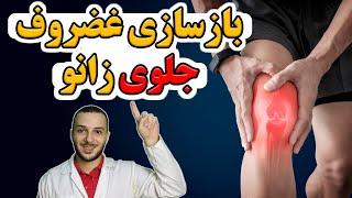 چطور نرمی غضروف زانوم رو در ۱۰ روز درمان کردم؟! بدون نیاز به پزشک