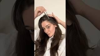 How I Actually Treated My Hairfall ‍️