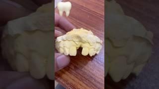 Immediate denture #umairtoothfairy #dentist #satisfying #umairazeem #shorts @Umairazeem8553