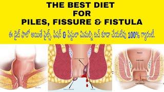 The Best Diet For Piles, Fissures &Fistula in Telugu