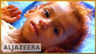 Yemen ‘could lose six million children’ from malnutrition