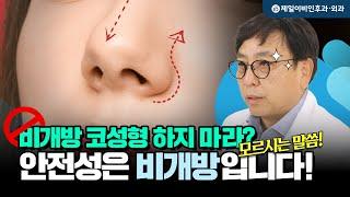 흔히 말하는 #비개방코성형 - 반은 맞고 반은 잘못된 말이다?