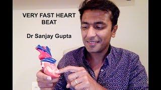 Very fast heartbeat