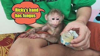 Dad applies nail fungus medicine to baby monkey Ricky