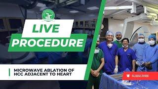 Microwave Ablation of HCC Adjacent to Heart | Dr. Sandeep Sharma | IRFACILITIES