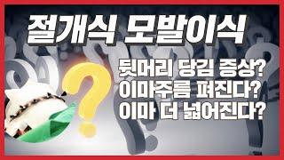 모발이식 부작용? 절개식 모발이식 후두부 당김증상 이마주름 이마넓어진다는데 과연 그런지 루트에서 답변드립니다.