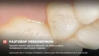 Image Putin and Trump on teeth