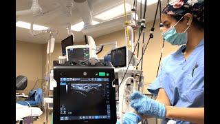 A day in the life of a board certified anesthesiologist assistant- arterial line placement, thoracic