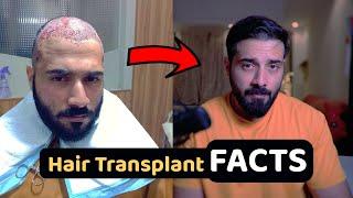 The Real Facts About Hair Transplantation You Need to Know Before Getting One