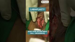 Labiaplasty Surgery, Vagina Tighten, Plastic Surgery at Elegance Clinic in Vesu, Surat