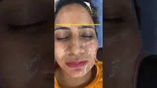 Oxygeneo Facial in Zirakpur | The Skin Zeal | Dr. Isha V. Mittal | Call 72-93-93-93-26