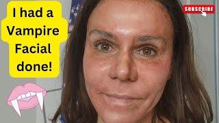 Vampire Facial Treatment for Anti-Aging