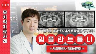 틀니 대신 선택할 수 있는 다양한 선택지, 확인해요~