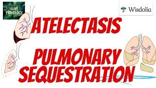 ATELECTASIS | PULMONARY SEQUESTRATION| Morphology| Types |  prognosis