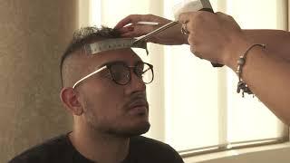 Vinci FUE Hair Transplant