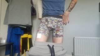 FTM UPDATE: Stage 2 pubic phalloplasty (1 week post op)