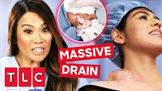 Exotic Dancer Gets MASSIVE CYST Drained Of White Pus By Dr. Lee | Dr. Pimple Popper: This Is Zit