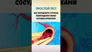 Тест на степень повреждения сосудов бляшками #сердце #атеросклероз #холестерин #сосуды