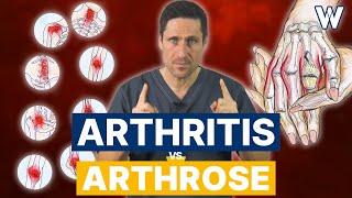 Arthrose vs. Arthritis: Gibts Unterschiede? Ursachen und Therapien von Gelenkschmerzen