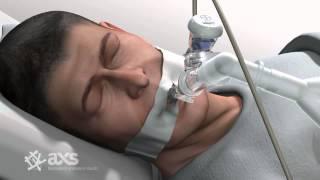 AXS Studio medical device animation drug delivery