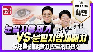 레이저 눈밑지방제거 vs 눈밑지방재배치 전격 비교 분석! I 무엇을 해야 할지 모르겠다면?