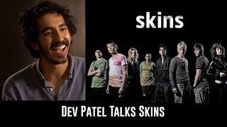 Dev Patel on 'Skins' & How it Shaped his Career