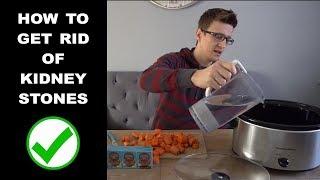 How to Get Rid of Kidney Stones!