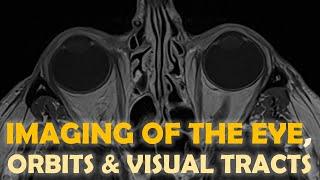 Imaging of the eye and visual system... more than meets the eye!