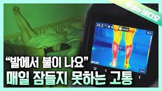 발이 타들어가는 듯한 고통 속에 살아가는 여인┃A Woman Living in Burning Pain