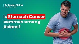 Is stomach cancer common among Asians? |  Gastric Cancer |  Dr  Sanket Mehta