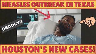 MEASLES OUTBREAK--TEXAS HIT HARD! FOR EDUCATIONAL PURPOSES ONLY