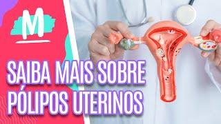 Saiba mais sobre PÓLIPOS UTERINOS - Mulheres (23/05/23)