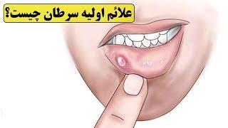 ۲۰ مورد از  ضعف ایمنی بدن و مهمترین علائم اولیه سرطان چیست؟