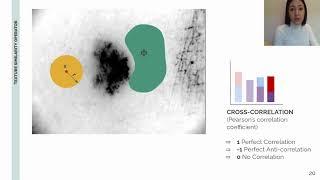 Feasibility of Spatial Model Checking for Nevus Segmentation