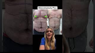 Masculoplasty Plus