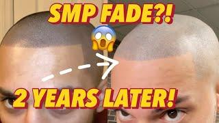 SMP 2 YEARS LATER! 4th Session! Permanent FADE?! (Scalp Micropigmentation)