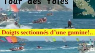 Doigts Arrachés Jeune Fille Tour des Yoles 2009 Martinique