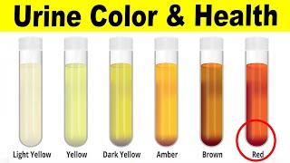 What The Color Of Your Urine Says About Your Health