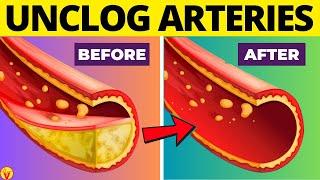 12 Drinks to UNCLOG ARTERIES And Prevent HEART ATTACK | VisitJoy