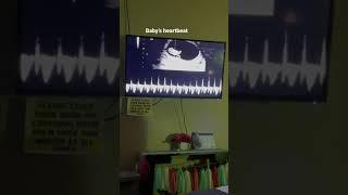 Ultrasound 2