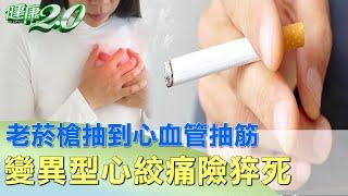 老菸槍抽到心血管抽筋 變異型心絞痛險猝死 健康2.0