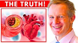 Dr. Paul Mason on Cholesterol & Heart disease