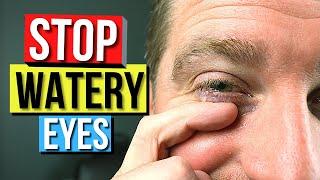 How To STOP EYES From WATERING! - Top 5 Causes and Remedies For Watery Eyes