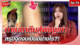 สาว โดนงูเห่ากัด ทาเบตาดีนสู้พิษงู สรุปจุดจบเป็นอย่างไร?!: Khaosod - ข่าวสด