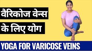 वैरिकोज वेन्स के लिए योग I Yoga for Varicose / Spider Veins I Tips to get rid of Varicose Veins