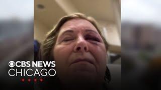 Patient's violent attack on hospital employee caught on video