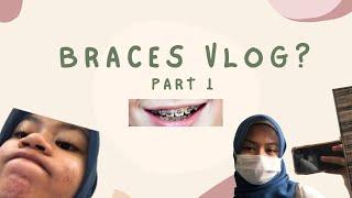 VLOG PART 1 | BRACES JOURNEY